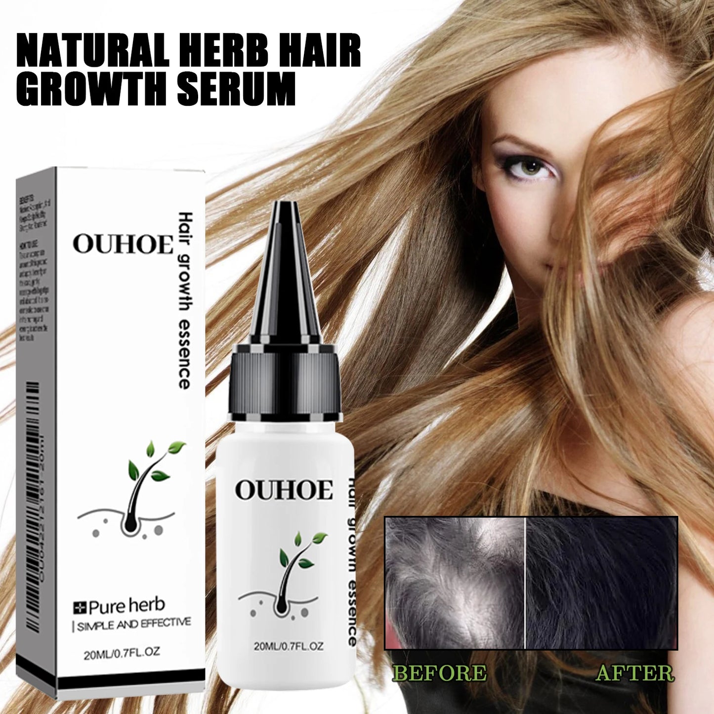 Herbal Dense Hair Growth
