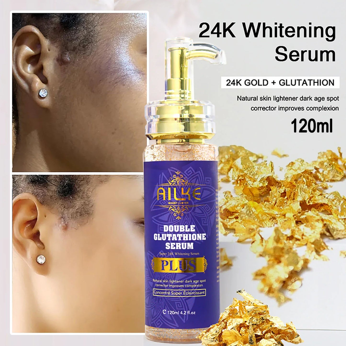 Anti Dark Spot Serum
