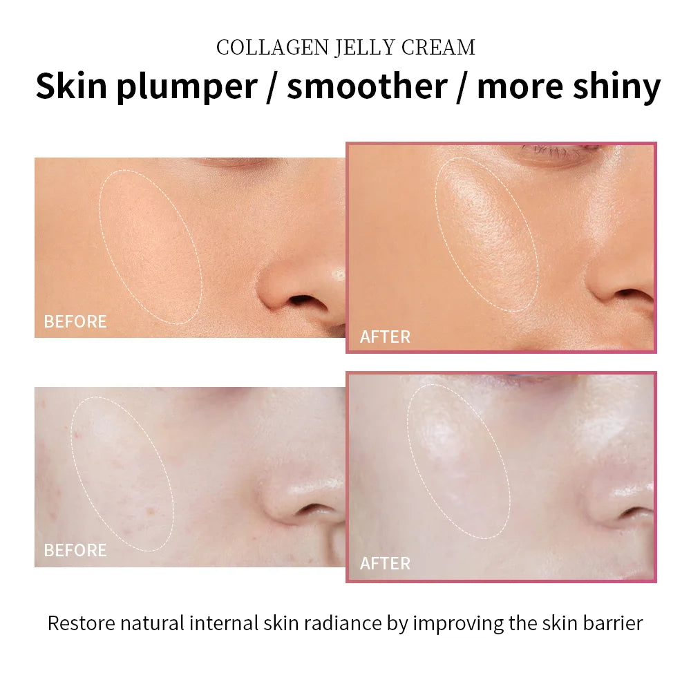 Collagen Jelly Cream