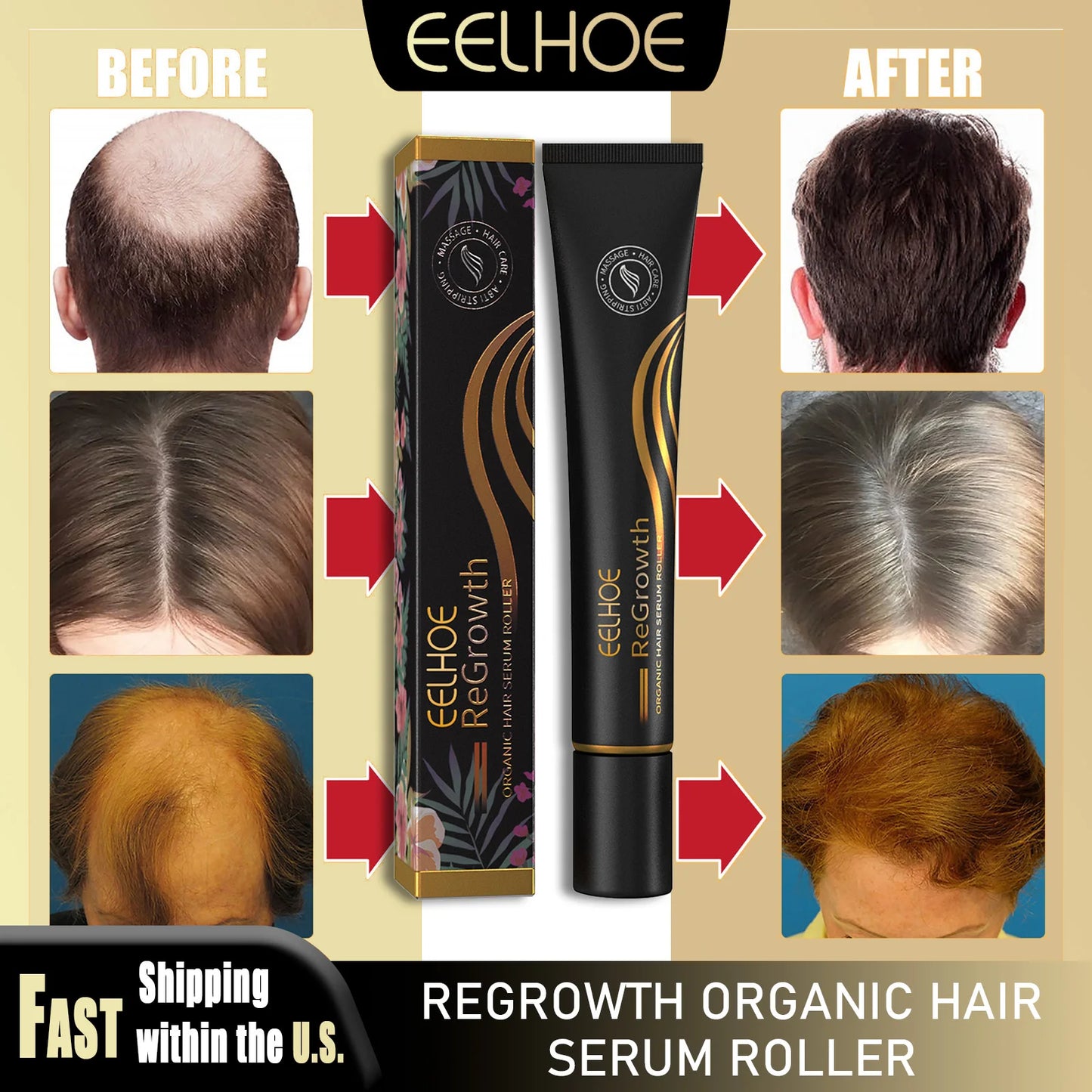 Regrowth Hair Serum