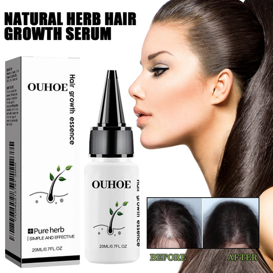 Herbal Dense Hair Growth